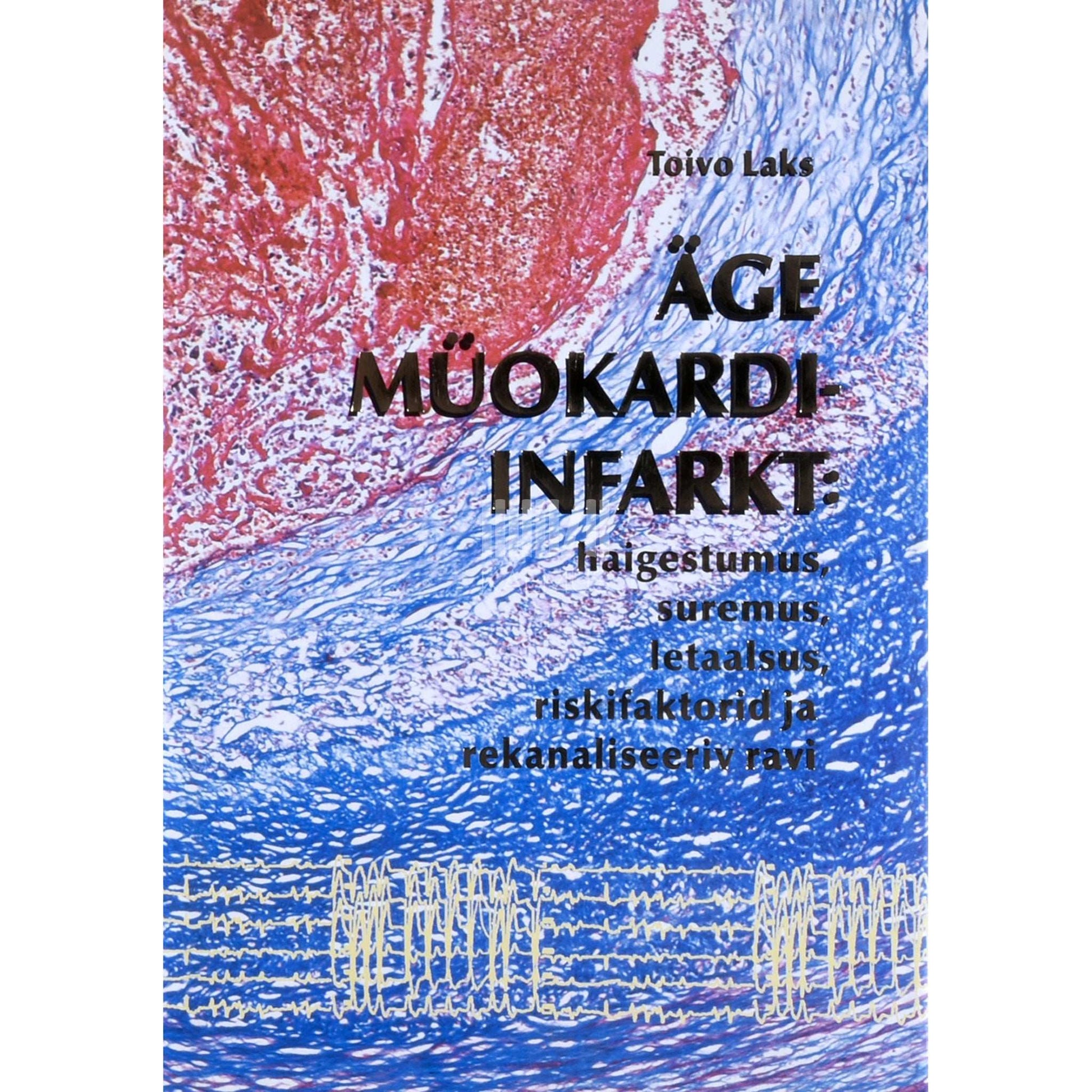 Toivo Laks - Äge müokardiinfarkt. Kliinilis-epidemioloogiline uurimus…
