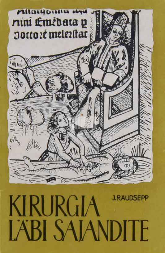 Kirurgia läbi sajandite - Kaemus