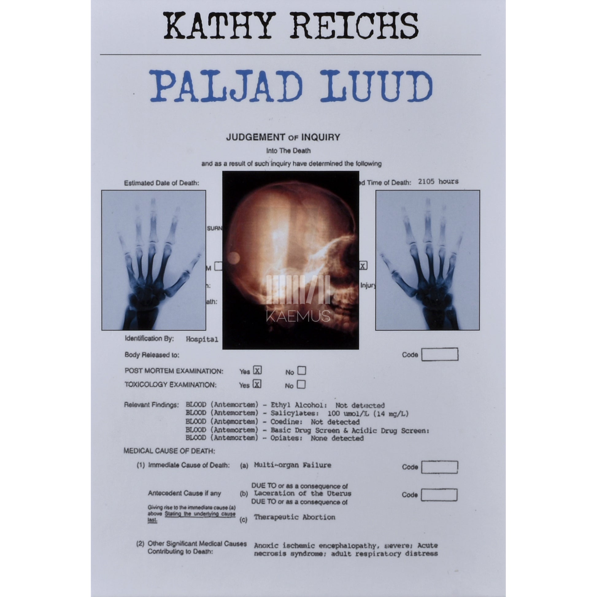 Kathy Reichs. Paljad luud