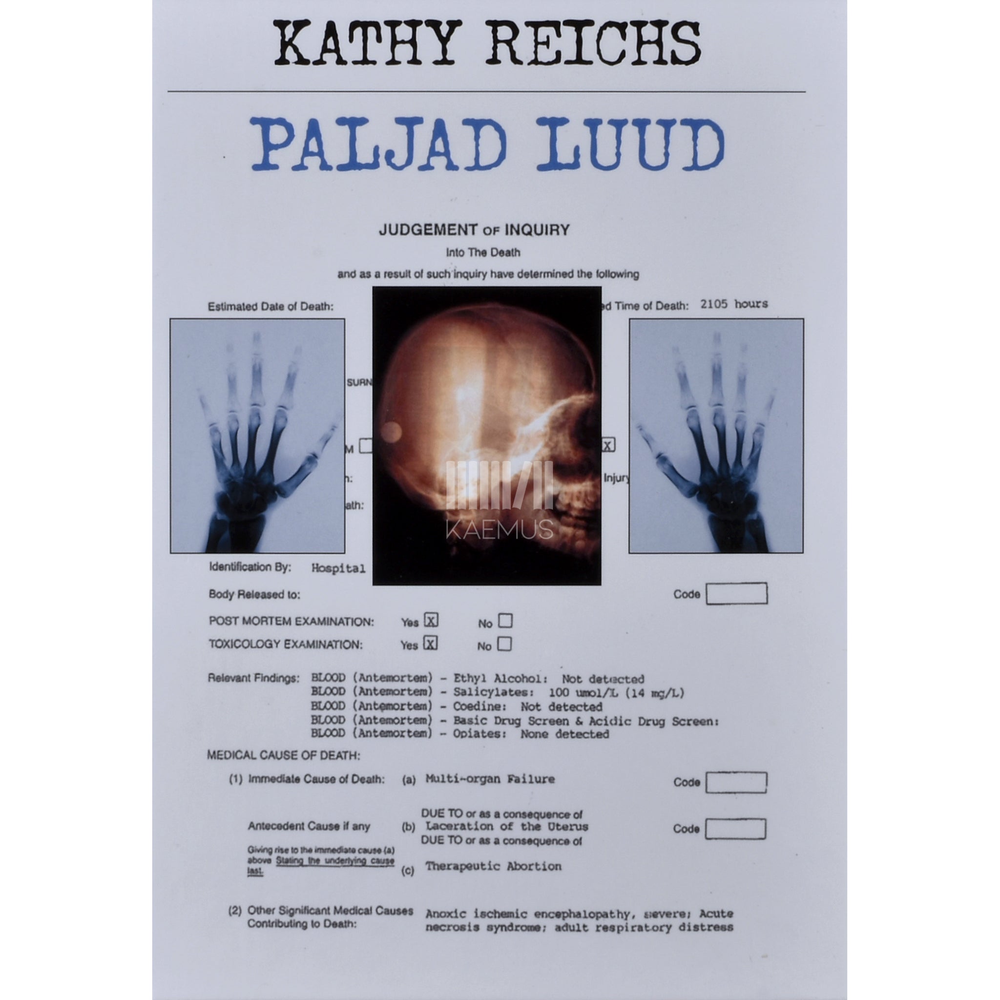Kathy Reichs Paljad luud